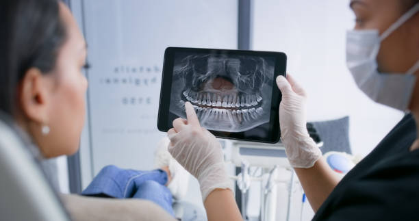 Licensed Wisdom Tooth Removal service in Spink County County, SD - Smile Center Dentistry